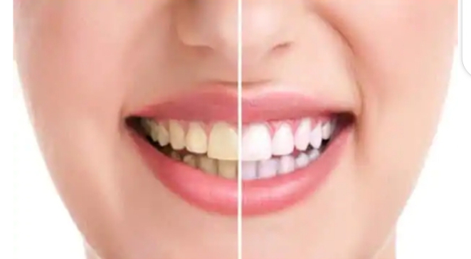 Brushing with force makes your teeth yellower, not whiter.